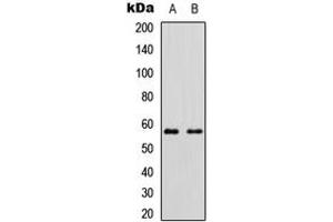 Western blot analysis of Cytochrome P450 11B2 expression in HEK293T (A), Raw264. (Cytochrome P450 11B2 (Center) anticorps)