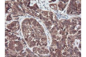 Image no. 3 for anti-RAB, Member of RAS Oncogene Family-Like 2A (RABL2A) antibody (ABIN1500575)