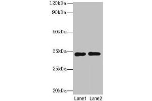 Western blot All lanes: Rgn antibody at 8 μg/mL Lane 1: A549 whole cell lysate Lane 2: HCT116 whole cell lysate Secondary Goat polyclonal to rabbit IgG at 1/10000 dilution Predicted band size: 34 kDa Observed band size: 34 kDa (Regucalcin anticorps  (AA 1-299))