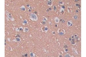 IHC-P analysis of Human Brain Tissue, with DAB staining. (KIF5A anticorps  (AA 473-605))
