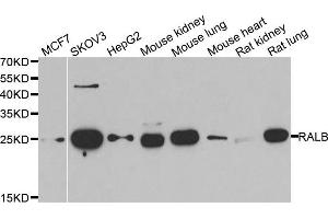 Western blot analysis of extracts of various cell lines, using RALB antibody. (RALB anticorps)
