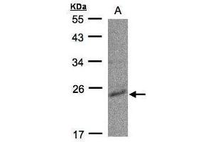 WB Image Sample(30 ug whole cell lysate) A:Raji , 12% SDS PAGE antibody diluted at 1:500