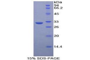 SDS-PAGE analysis of Human EPHA1 Protein. (EPHA1 Protéine)