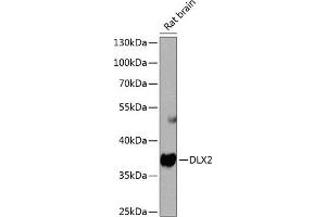 Western blot analysis of extracts of rat brain, using DLX2 antibody  at 1:1000 dilution. (DLX2 anticorps  (AA 1-140))