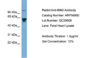 WB Suggested Anti-BIN2  Antibody Titration: 0.