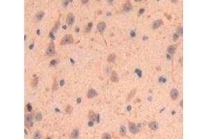 #VALUE! (CRYGF anticorps  (AA 1-173))