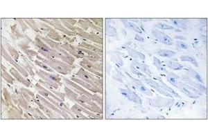 Immunohistochemistry analysis of paraffin-embedded human heart tissue, using MRPL16 Antibody.