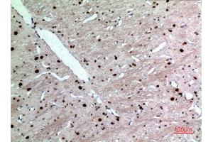 Immunohistochemistry (IHC) analysis of paraffin-embedded Rat Brain, antibody was diluted at 1:100. (KRT14 anticorps  (C-Term))