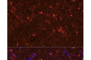 Immunofluorescence analysis of Rat brain using GAD2 Polyclonal Antibody at dilution of 1:100 (40x lens). (GAD65 anticorps)