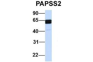 Host:  Rabbit  Target Name:  PAPSS2  Sample Type:  Human 721_B  Antibody Dilution:  1. (PAPSS2 anticorps  (C-Term))