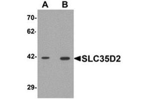Western blot analysis of SLC35D2 in HeLa cell lysate with SLC35D2 Antibody  at (A) 1 and (B) 2 μg/ml. (Solute Carrier Family 35 (UDP-GlcNAc/UDP-Glucose Transporter), Member D2 (SLC35D2) (C-Term) anticorps)