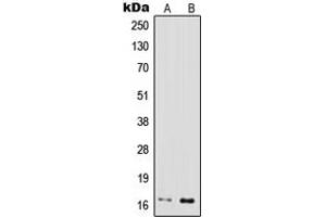Western blot analysis of IFN gamma expression in MOLT4 (A), Jurkat (B) whole cell lysates. (Interferon gamma anticorps  (Center))