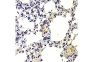 Immunohistochemistry of paraffin-embedded mouse lung using HDAC5 antibody (ABIN6290464) at dilution of 1:100 (40x lens). (HDAC5 anticorps)