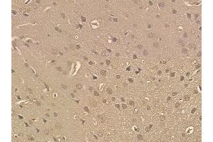 SND1 Mouse Monoclonal Antibody at 1/100 staining rat brain tissue by IHC-P. (SND1 anticorps)