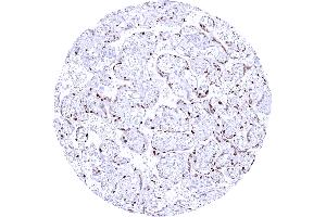 Mature placenta showing a strong Cyclin E1 staining of most cytotrophoblast cells (Recombinant Cyclin E1 anticorps)