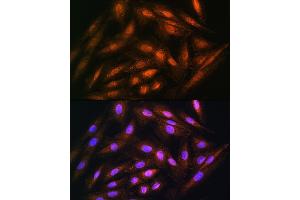 Immunofluorescence analysis of H9C2 cells using DUSP14 Rabbit pAb (ABIN6127789, ABIN6139865, ABIN6139866 and ABIN6214482) at dilution of 1:100.