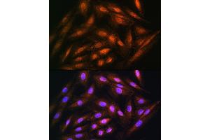 Immunofluorescence analysis of H9C2 cells using DUSP14 Rabbit pAb (ABIN6127789, ABIN6139865, ABIN6139866 and ABIN6214482) at dilution of 1:100. (DUSP14 anticorps  (AA 1-198))
