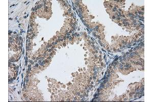 Immunohistochemical staining of paraffin-embedded colon tissue using anti-PDE4A mouse monoclonal antibody. (PDE4A anticorps)