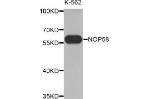 Western blot analysis of extracts of K-562 cell line, using NOP58 antibody. (NOP58 anticorps  (AA 360-529))