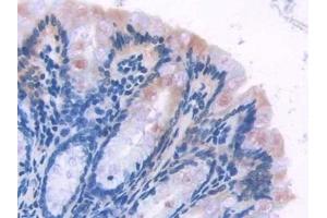 Detection of MB21D1 in Mouse Intestine Tissue using Polyclonal Antibody to Mab21 Domain Containing Protein 1 (MB21D1)