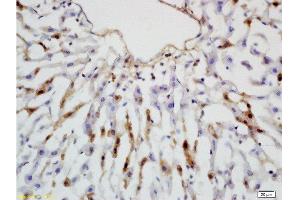 Formalin-fixed and paraffin embedded rat colon tissue labeled with Rabbit Anti-Leptin receptor(long) Polyclonal Antibody  at 1:200 followed by conjugation to the secondary antibody and DAB staining