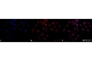 Immunocytochemistry/Immunofluorescence analysis using Mouse Anti-Hsp47 Monoclonal Antibody, Clone 1C4-1A6 . (SERPINH1 anticorps)