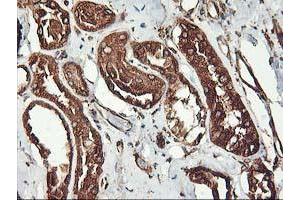 Immunohistochemical staining of paraffin-embedded Human Kidney tissue using anti-KCNAB1 mouse monoclonal antibody. (KCNAB1 anticorps)