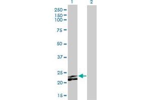 Western Blot analysis of FGF23 expression in transfected 293T cell line by FGF23 MaxPab polyclonal antibody. (FGF23 anticorps  (AA 1-251))