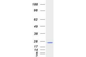 Validation with Western Blot
