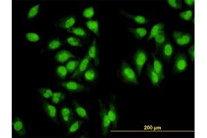Immunofluorescence of monoclonal antibody to SYMPK on HeLa cell.