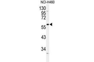 Western blot analysis of ADRA1B Antibody (Center) in NCI-H460 cell line lysates (35µg/lane). (ADRA1B anticorps  (Middle Region))