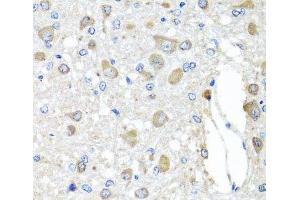 Immunohistochemistry of paraffin-embedded Rat brain using BAG5 Polyclonal Antibody at dilution of 1:100 (40x lens). (BAG5 anticorps)