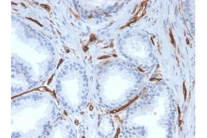 Formalin-fixed, paraffin-embedded human prostate stained with CD31 Mouse Monoclonal Antibody (PECAM1/3527). (CD31 anticorps  (AA 625-738))