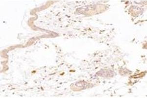 Immunohistochemistry analysis of paraffin-embedded mouse skin using,NT5C1B (ABIN7072861) at dilution of 1: 1200