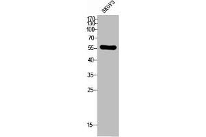 Western Blot analysis of SKOV3 cells using CD292 Polyclonal Antibody (BMPR1A anticorps  (N-Term))