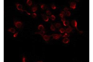 ABIN6275336 staining COLO205 by IF/ICC.