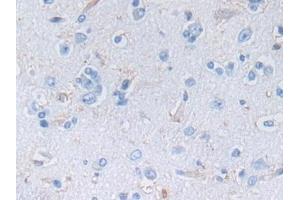 Detection of NES in Human Cerebrum Tissue using Polyclonal Antibody to Nestin (NES)