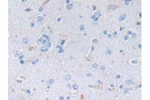 Detection of NES in Human Cerebrum Tissue using Polyclonal Antibody to Nestin (NES) (Nestin anticorps  (AA 178-399))
