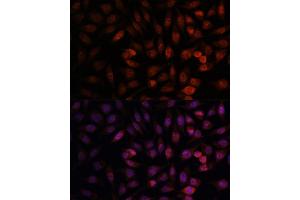 anti-DEAD (Asp-Glu-Ala-Asp) Box Polypeptide 24 (DDX24) (AA 510-859) antibody