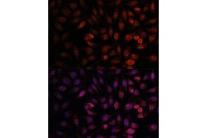 Immunofluorescence analysis of L929 cells using DDX24 antibody (ABIN7266691) at dilution of 1:100. (DDX24 anticorps  (AA 510-859))