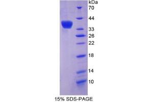 SDS-PAGE analysis of Mouse Olfactomedin 4 Protein. (Olfactomedin 4 Protein (OLFM4))