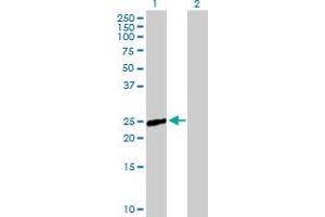 Western Blot analysis of RAB9B expression in transfected 293T cell line by RAB9B MaxPab polyclonal antibody. (RAB9B anticorps  (AA 1-201))
