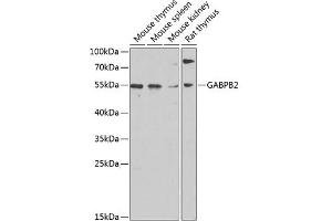 Western blot analysis of extracts of various cell lines, using G antibody (ABIN6130410, ABIN6140895, ABIN6140896 and ABIN6220279) at 1:1000 dilution. (GABPB2 anticorps  (AA 239-448))