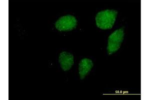 Immunofluorescence of purified MaxPab antibody to VCX3A on HeLa cell. (VCX3A anticorps  (AA 1-166))