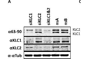 The effect of KLC knock-down by siRNA on virus egress. (KLC1 anticorps)