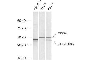 dilution: 1 : 1000, sample: rat brain homogenate (Calbindin D28k/D29k anticorps)