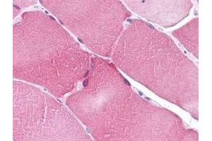 Immunohistochemistry of ARC in human heart tissue (A) and skeletal muscle (B) with ARC antibody at 5 μg/ml. (NOL3 anticorps  (C-Term))