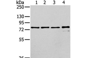 Western Blot analysis of Raji, K562, skov3 and pc3 cell using GHR Polyclonal Antibody at dilution of 1/400 (Growth Hormone Receptor anticorps)