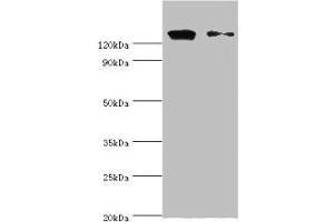 Western blot All lanes: CCAR1 antibody at 10 μg/mL Lane 1: Hela whole cell lysate Lane 2: PC-3 whole cell lysate Secondary Goat polyclonal to rabbit IgG at 1/10000 dilution Predicted band size: 133, 132 kDa Observed band size: 133 kDa (CCAR1 anticorps  (AA 1-200))