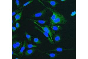 IF analysis of Cytokeratin 18 using anti-Cytokeratin 18 antibody (ABIN7600573). (Cytokeratin 18 anticorps  (AA 204-430))